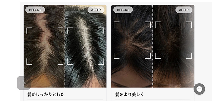 ビフォーアフター画像